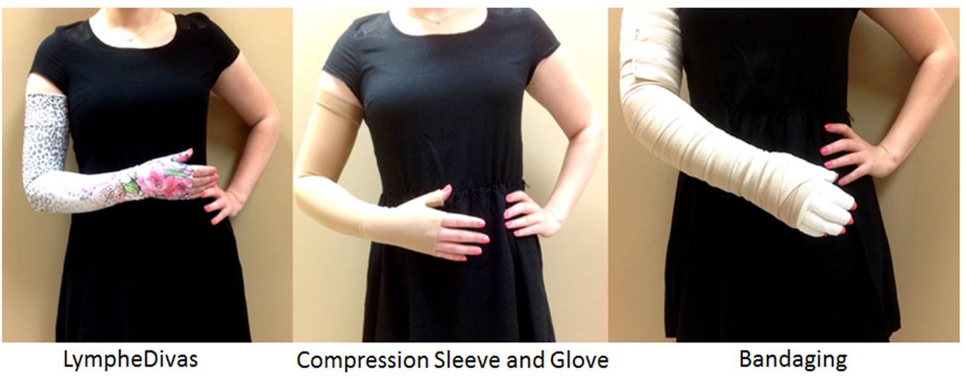 LympheDivas, Compression Sleeve, Compression Gauntlet